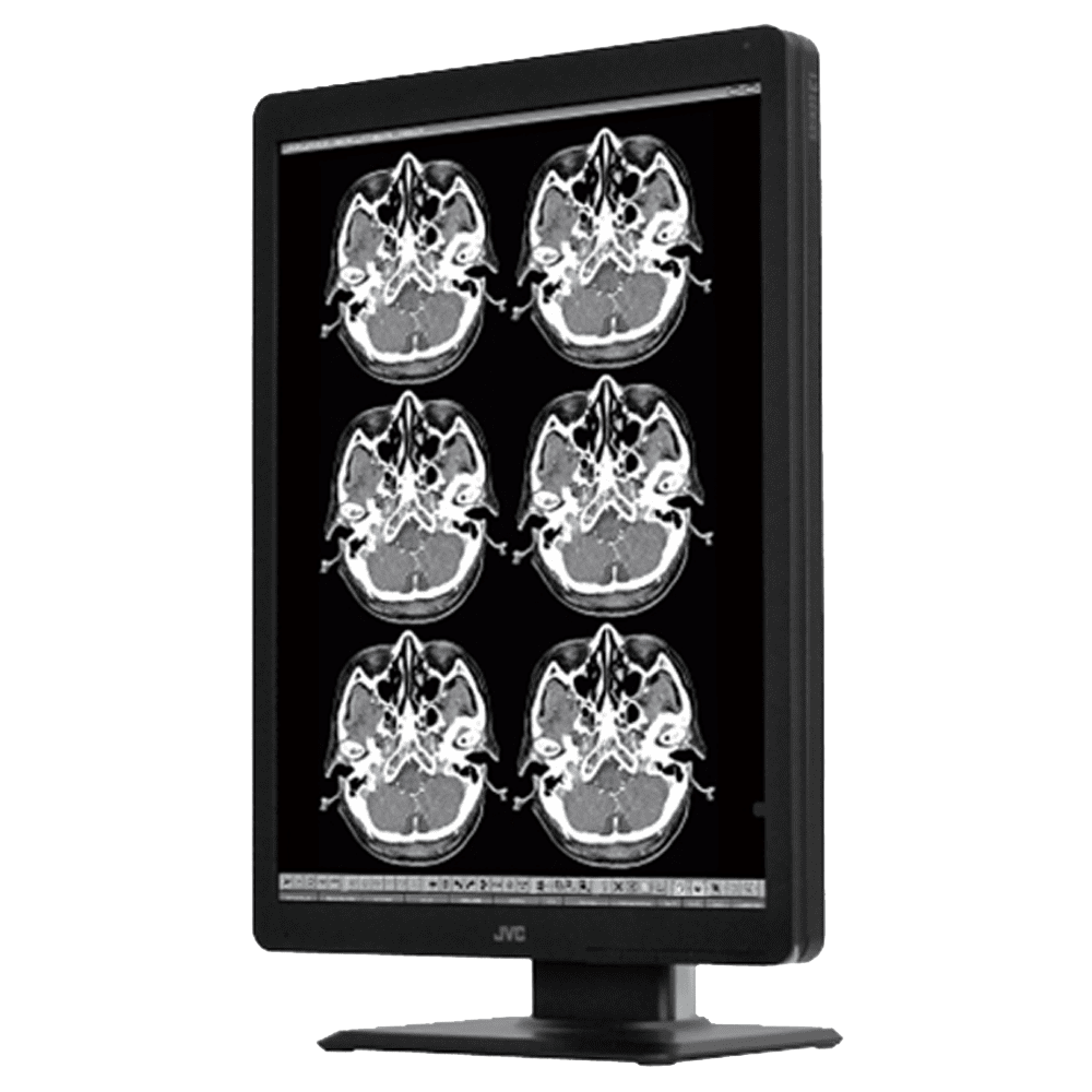 JVC MS-S200 2MP Monochrome Medical Monitor - MSS200