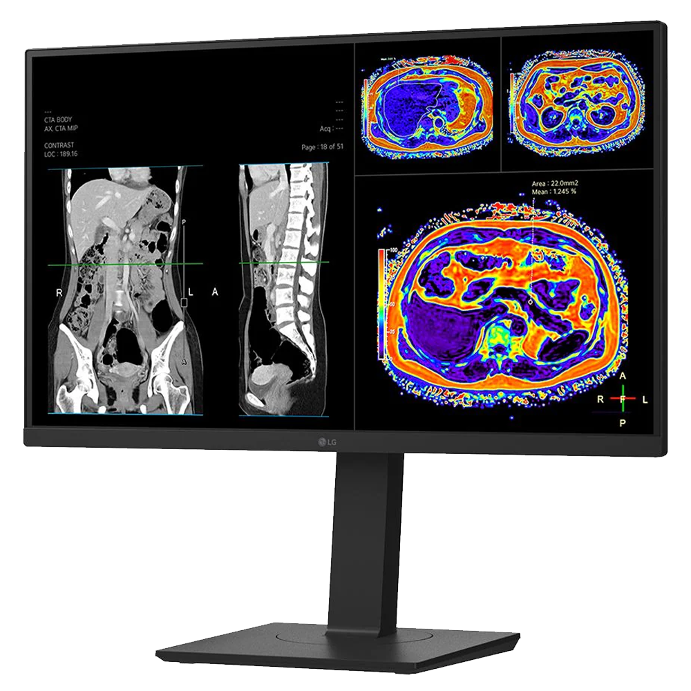 LG 27HS713C-B 27" 8MP IPS Clinical Review Monitor