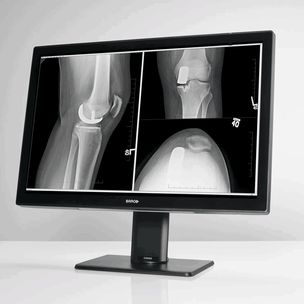 Barco MDCC-6530 6MP Diagnostic Display Monitor - MDCC6530
