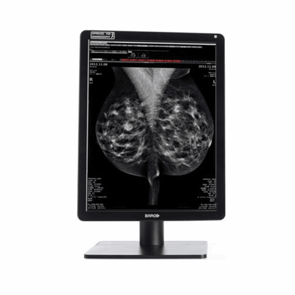 Barco MDNC-6121 (MDNC6121) Diagnostic Radiology Monitor
