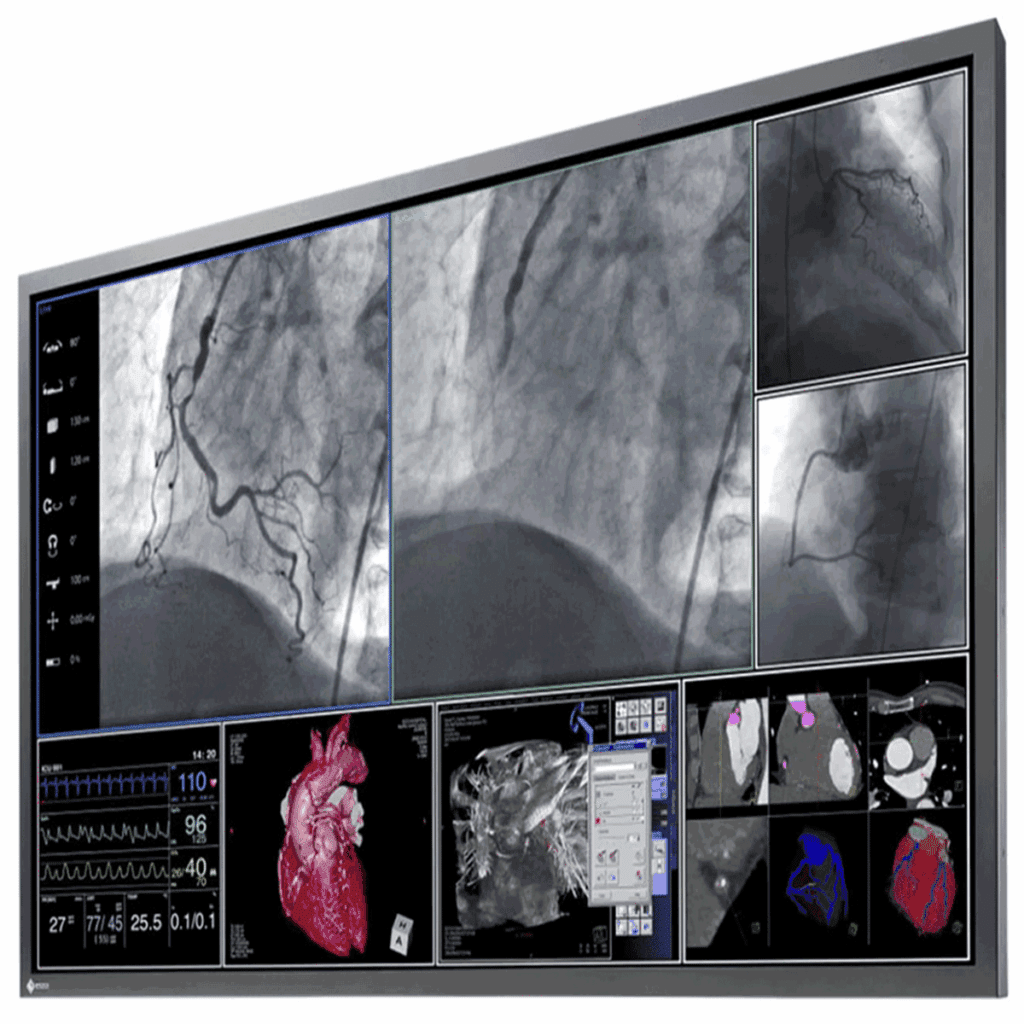 Eizo LS580W Cath Lab Display Monitor