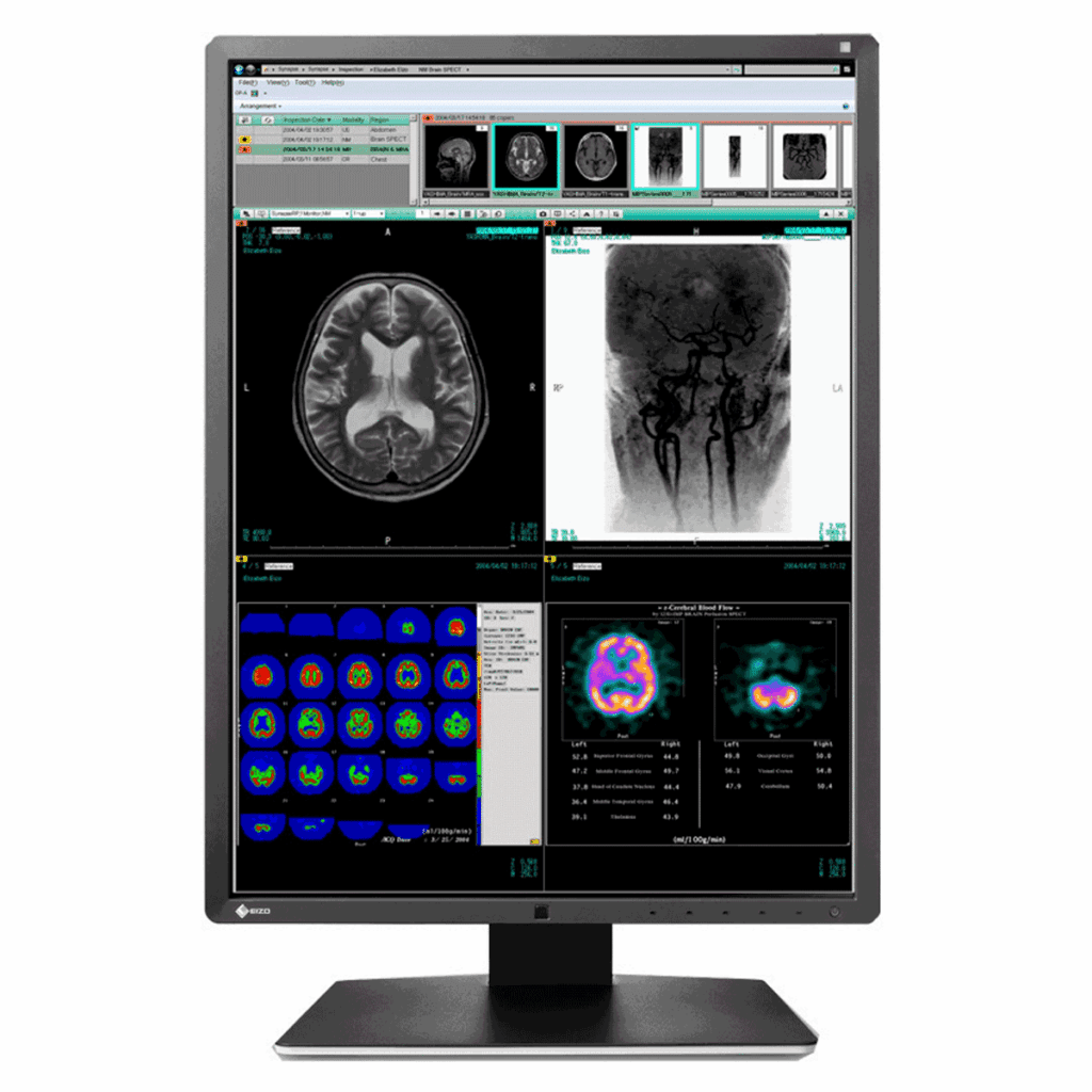 Eizo RX350-BK 3MP Diagnostic Radiology Monitor - RX350BK