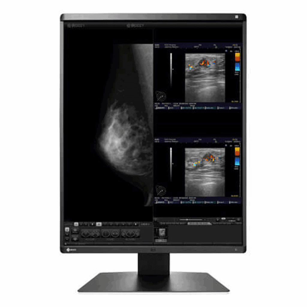 Eizo RX560-BK 5MP Mammography Display Monitor - RX560BK
