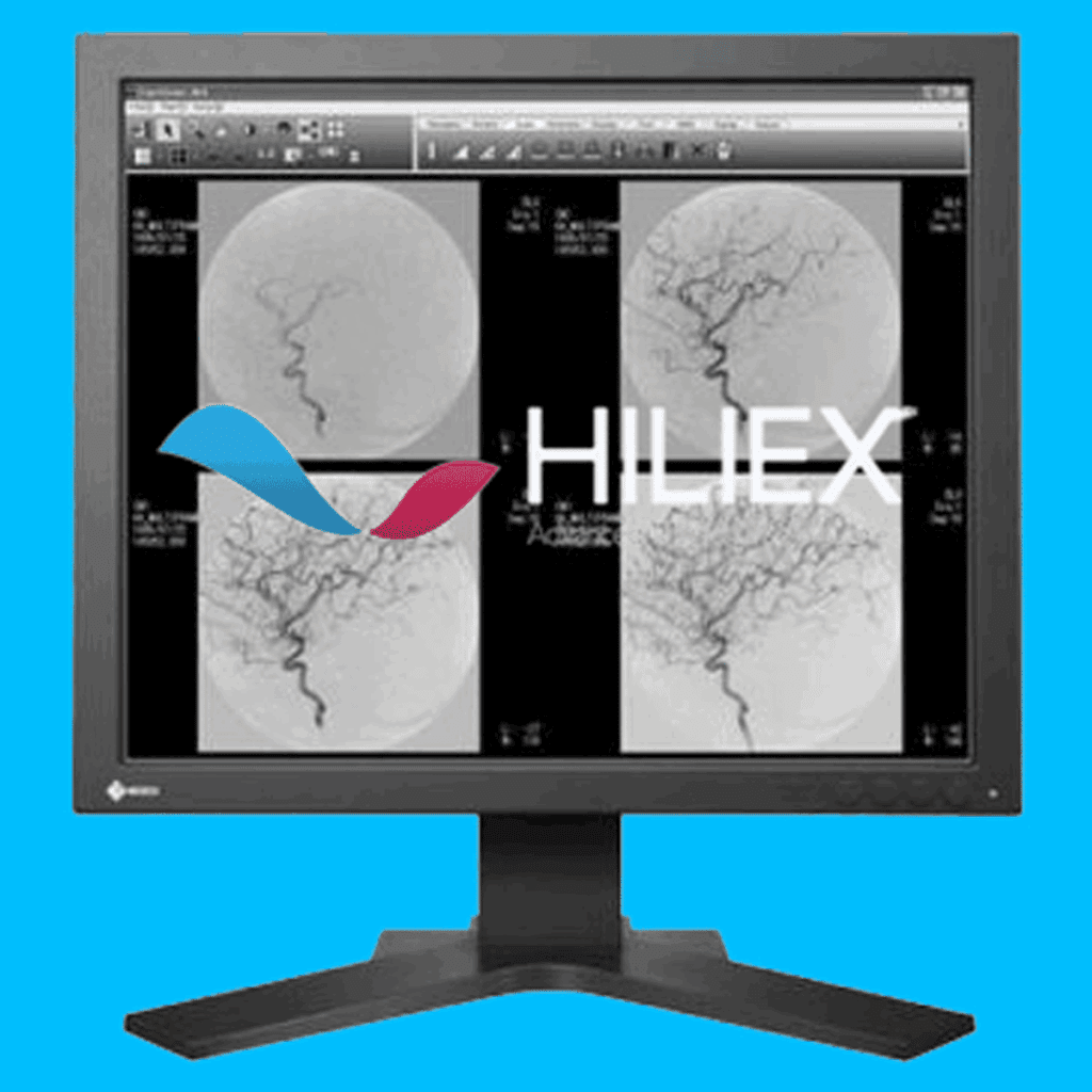 GE SMD 19100 G Medical Display - SMD19100G
