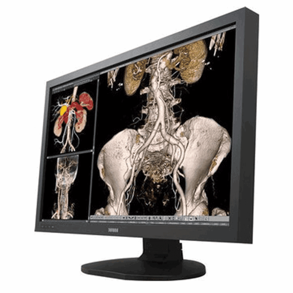 JVC CCL650i2 6MP Diagnostic Radiology Monitor