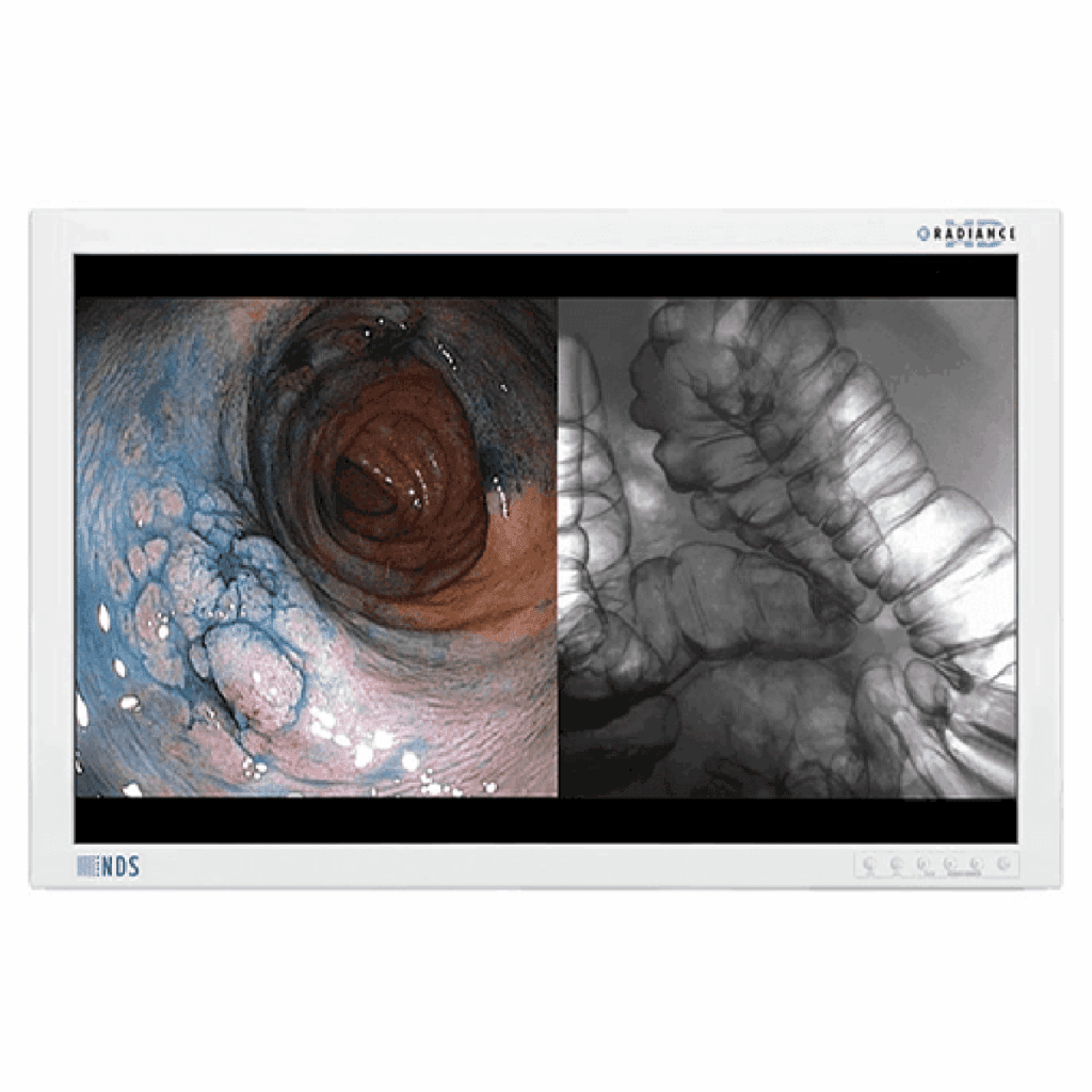 NDS Radiance 42 Surgical Display -90R0070