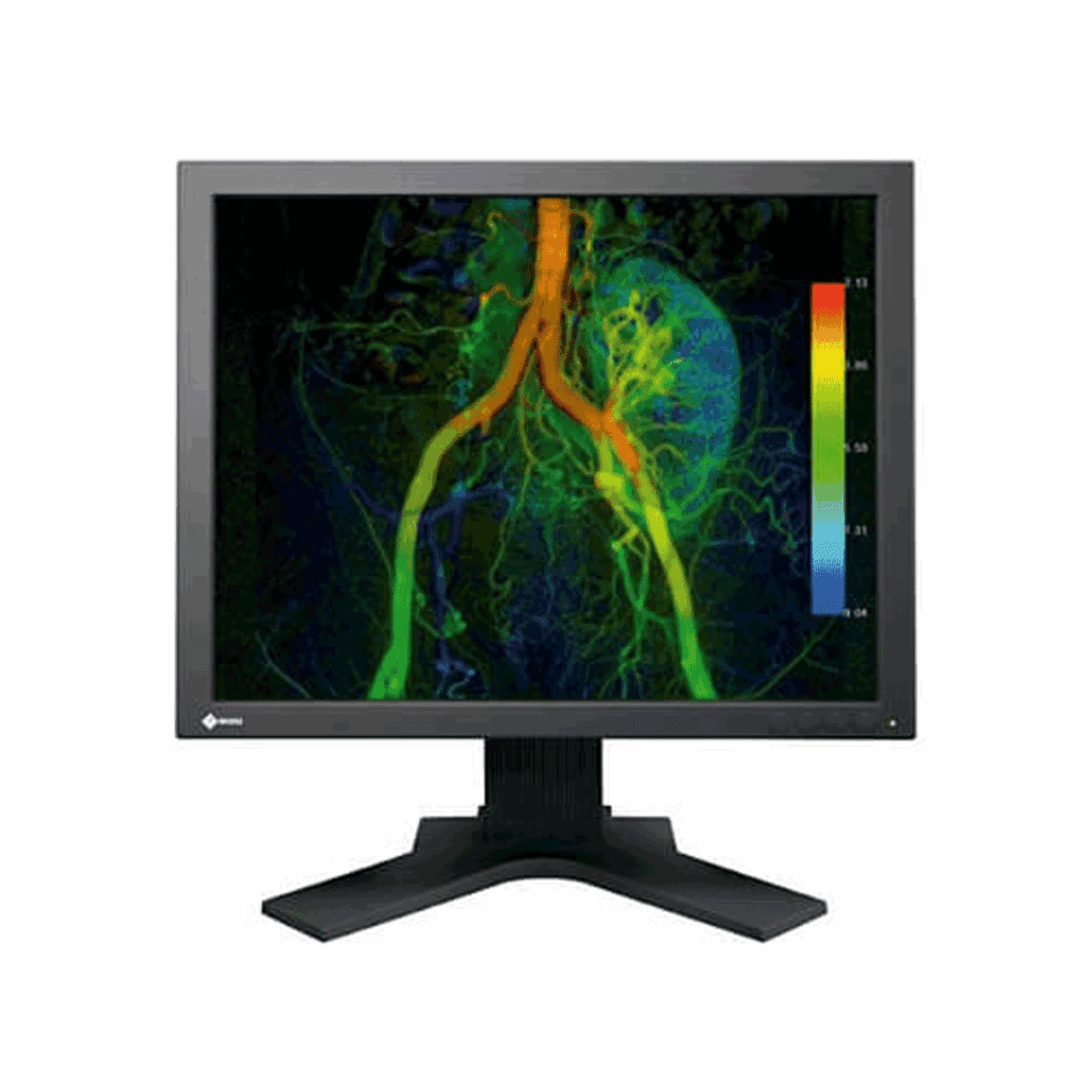 Eizo CuratOR EX190-S Medical Monitor - EX190S