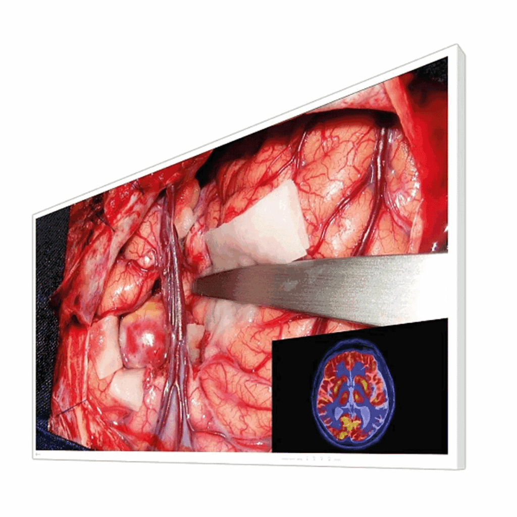 Eizo CuratOR EX5542 Surgical Display