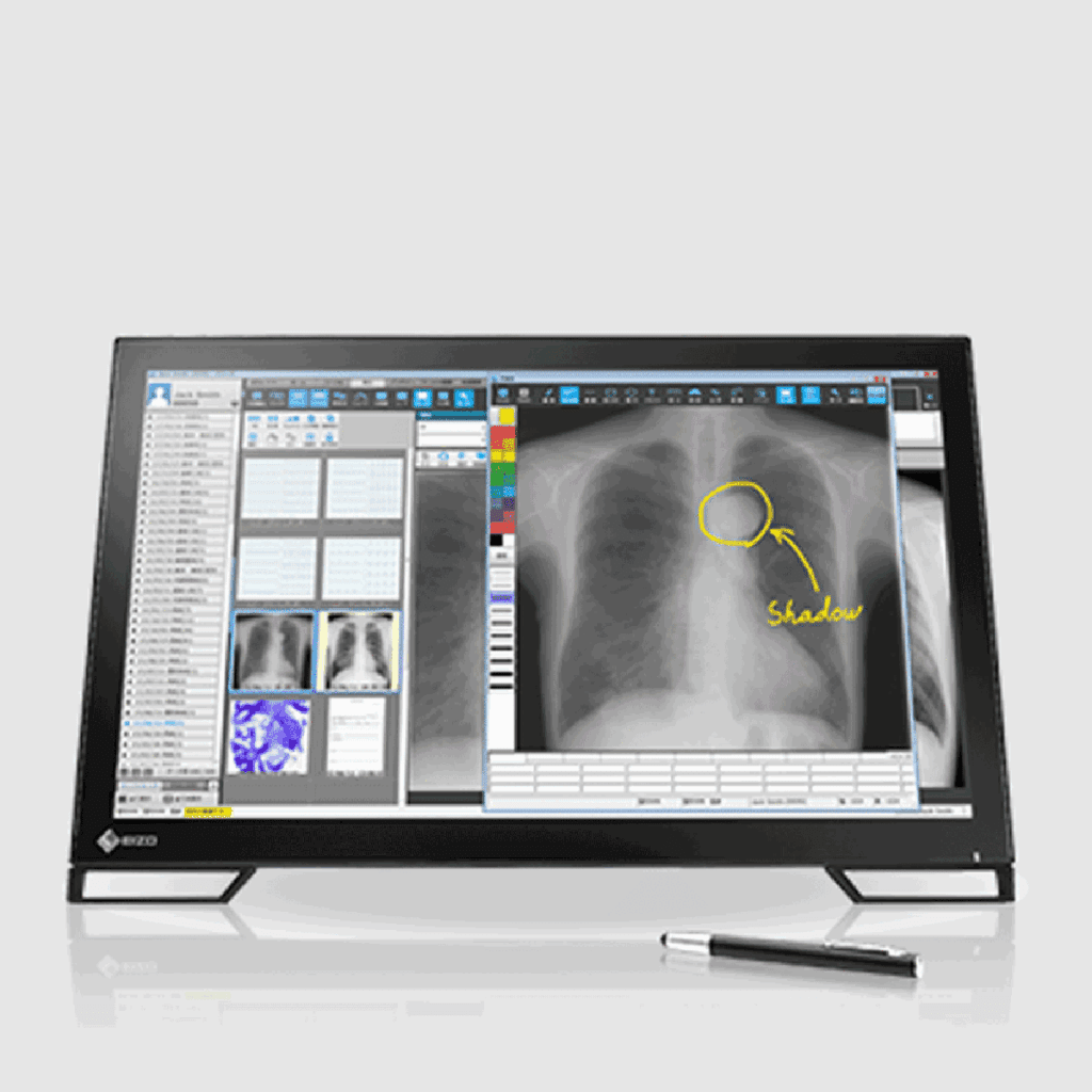 Eizo RadiForce MS236WT Medical Multitouch Monitor