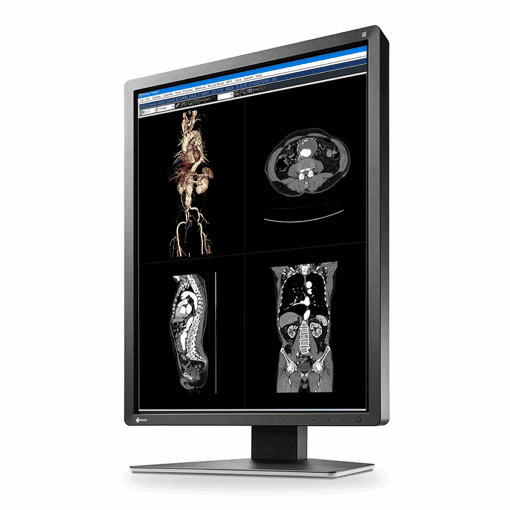 Eizo RadiForce MX216-BK Clinical Review Display - MX216BK