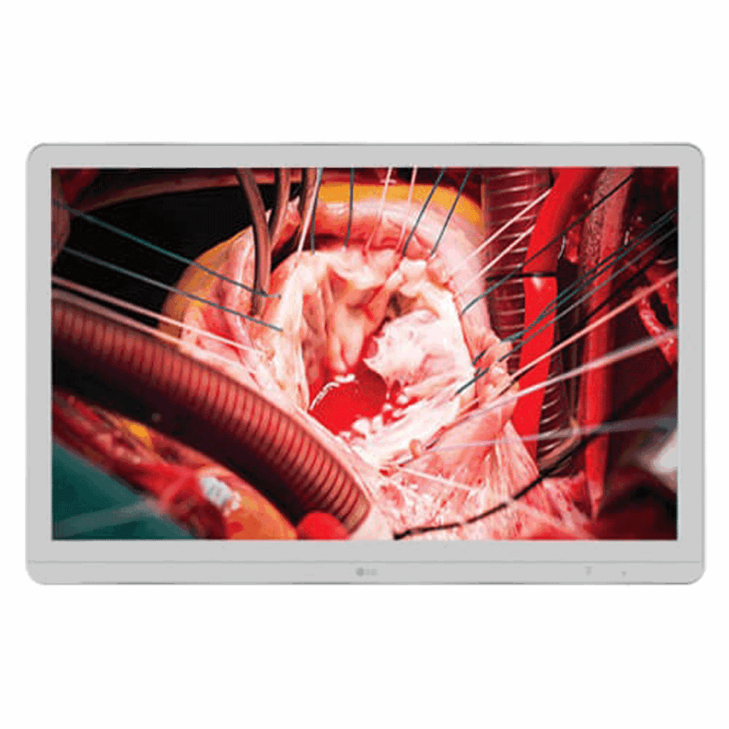 LG 27HK510S-W Surgical Display - 27HK510SW