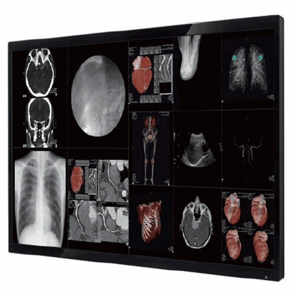 Optik View SC55844 4K Surgical Display - SC55844X