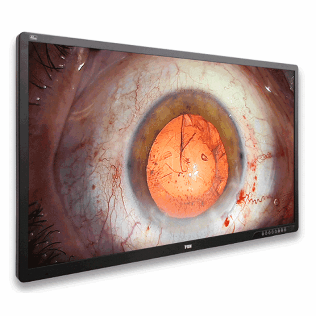 FSN FM-A5505DGC Surgical Display (FMA5505DGC)