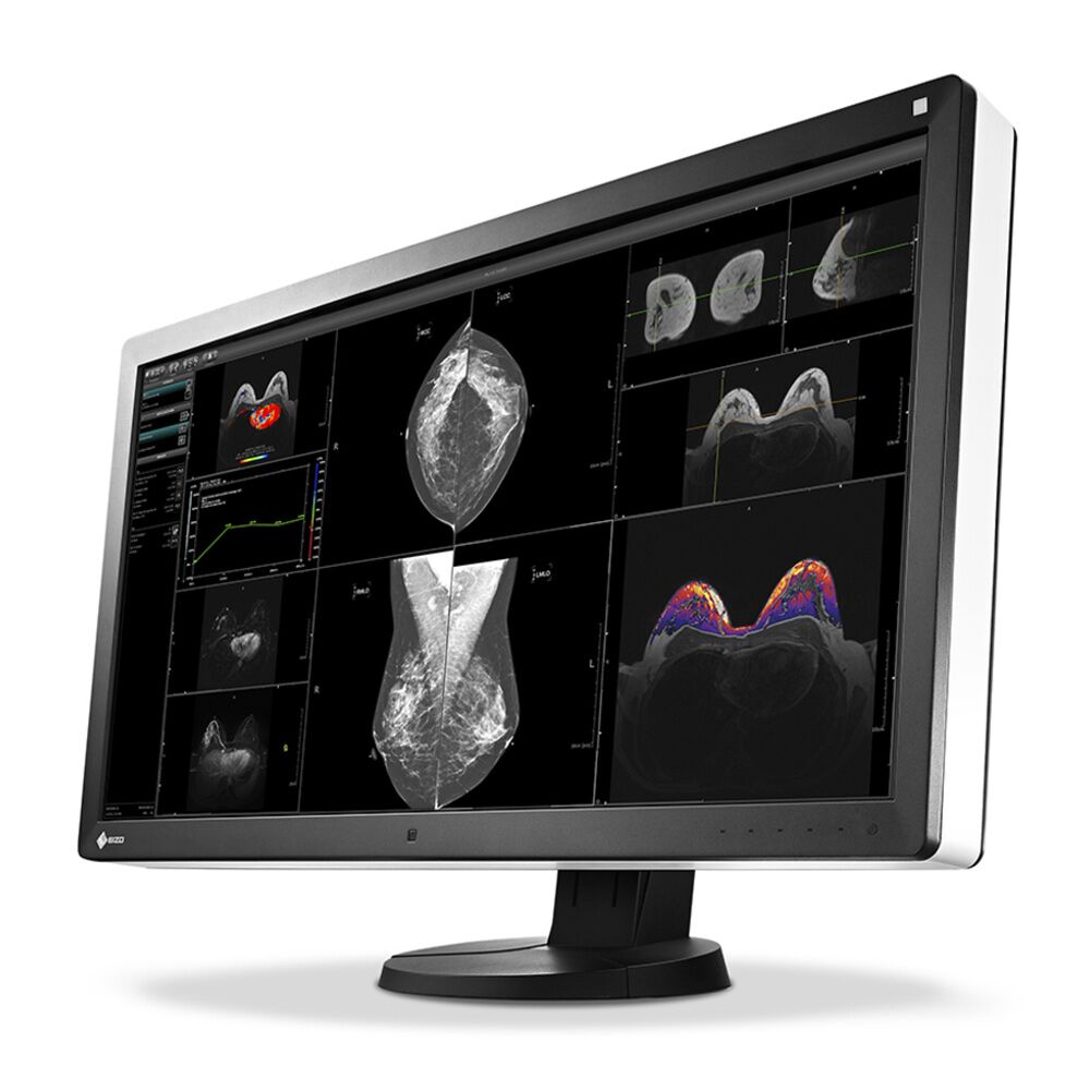 Eizo RX850 8MP