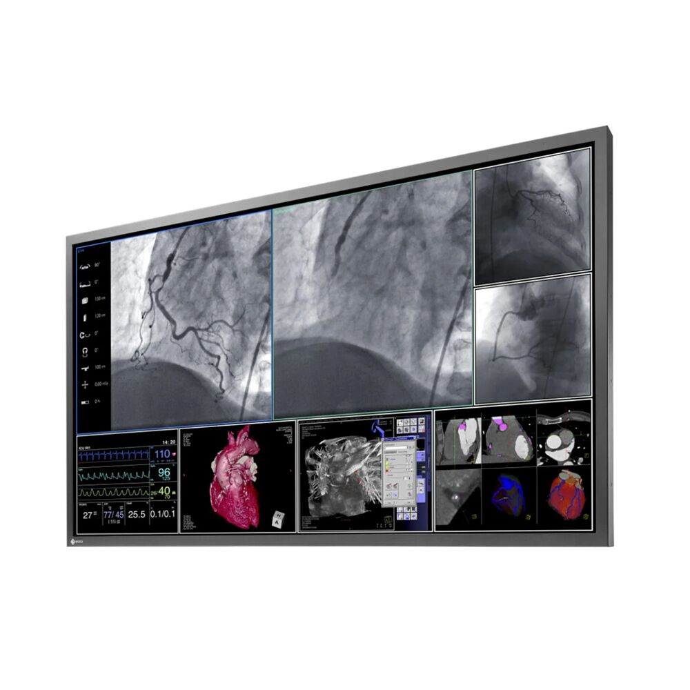 Eizo LS580W 58" Cath Lab Display