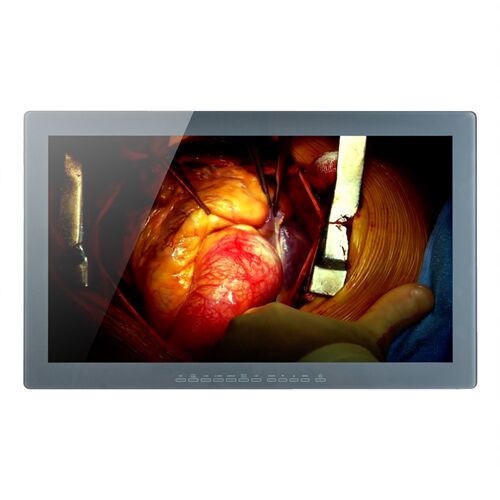 Optik View SC2612 26" Color Surgical Display