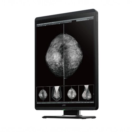 JVC MS-S500 5MP 21.3" Digital Mammography LCD Monitor