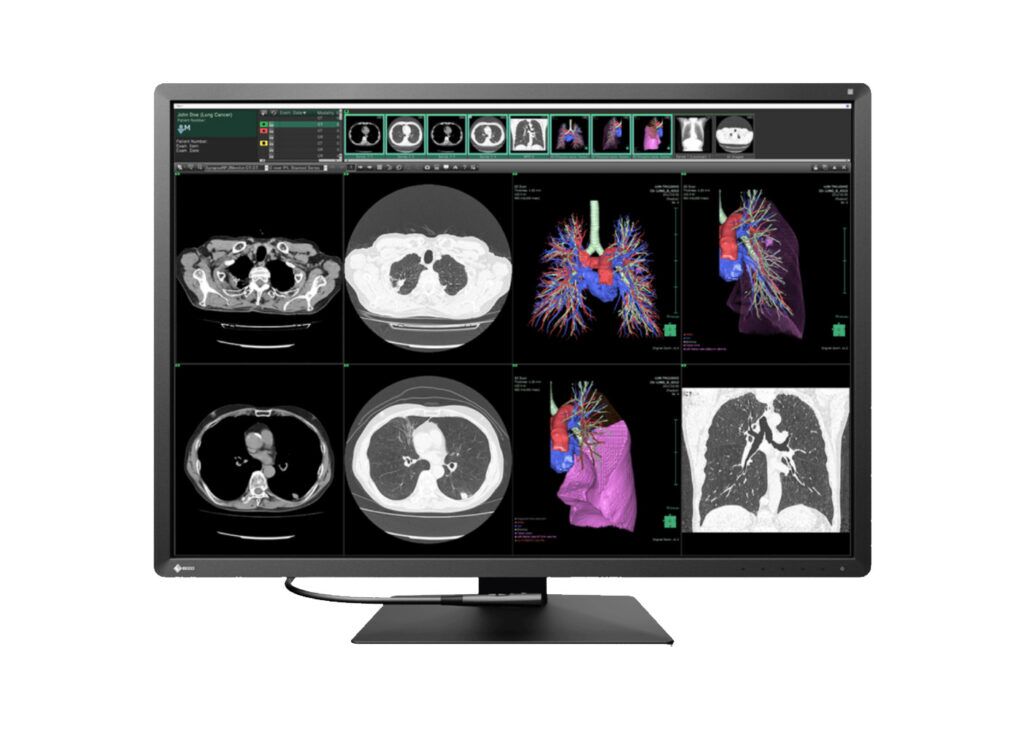 Eizo RX1270 12MP
