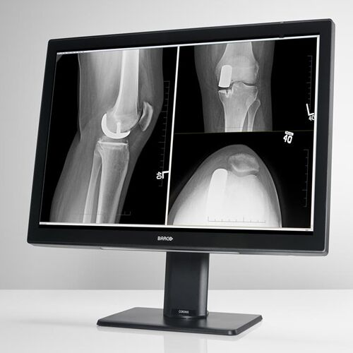 Barco MDCC-4430 Coronis Fusion 4MP