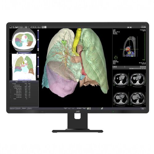 JVC CL-R813 32" 8MP Color Diagnostic Display