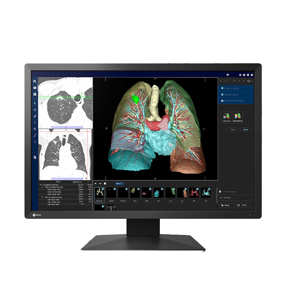 Eizo MX243W 2.3MP