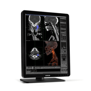 EIZO カラー液晶モニター RadiForce MX242W 表示使用時間0H RadiForce MX242W 2.3MP Widescreen Monitor with DICOM | EIZO
