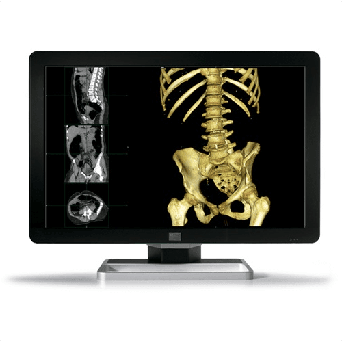 Barco MDCC-6330 Coronis Fusion 6MP LED Diagnostic Display (MDCC6330)