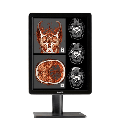 Barco MDNC-2221 Nio Color 2MP