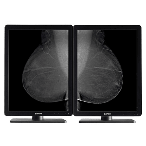 Barco MDNG-5221 Nio 5MP - MDNG5221