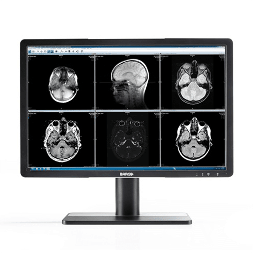 Barco MDRC-2122 TS Eonis 22"