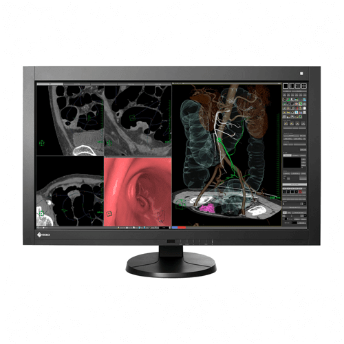 Eizo MX242W-BK 24" Diagnostic Display