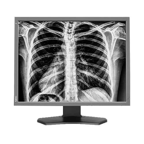 NEC MD212G3 3MP Grayscale Diagnostic Display Sales | Hiliex