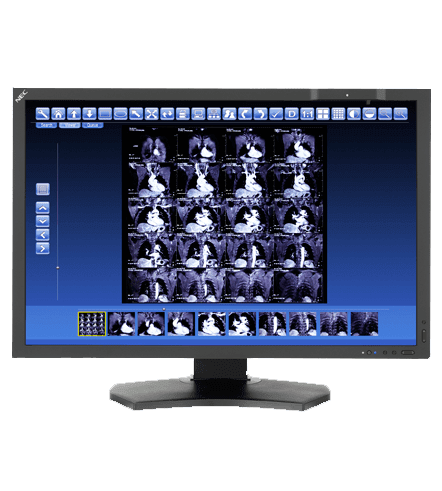 NEC MD302C4 30” 4MP Color Medical Diagnostic Display
