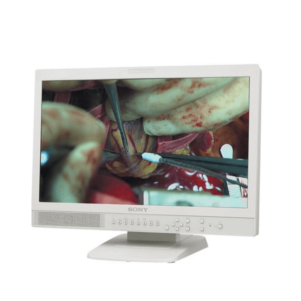 Sony LMD-2110MD 21.5" FHD LCD Medical Monitor - LMD2110MD