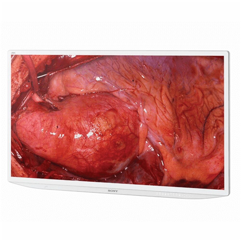 Sony LMD-X550MD 55-inch 4K 2D LCD Medical Monitor - LMDX550MD