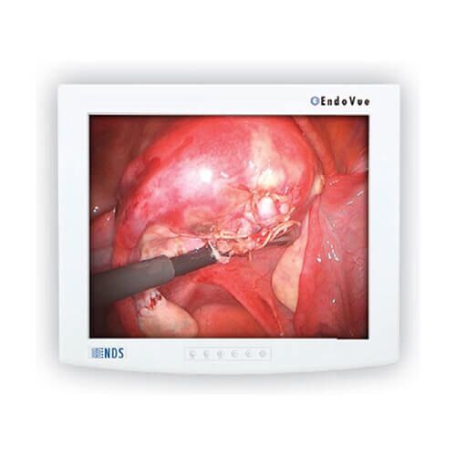 NDSsi 90K0016 19" EndoVue HD LED Surgical Display