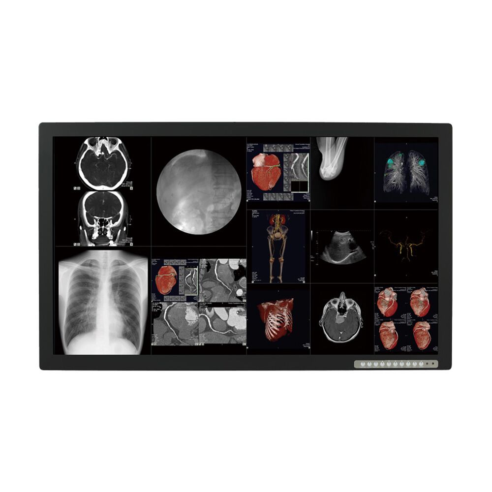 Optik View SC4212 42" Surgical Display Monitor