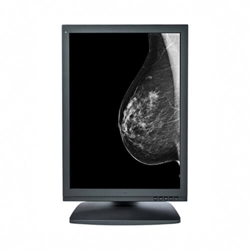 Optik View DM21510 5MP Grayscale Diagnostic Display