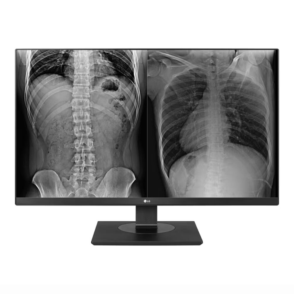 LG 27HJ713C-B 27-inch 8MP Clinical Review Display - 27HJ713CB