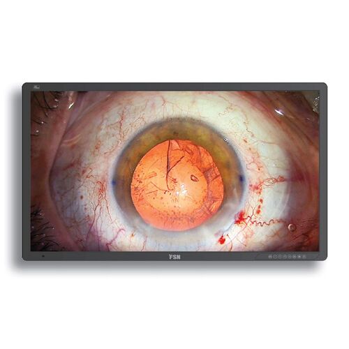 FSN FM-A5503DGC 55" 4K 3D UHD Surgical Display