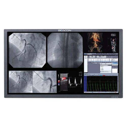 Beacon S551 55" 4K Surgical Display