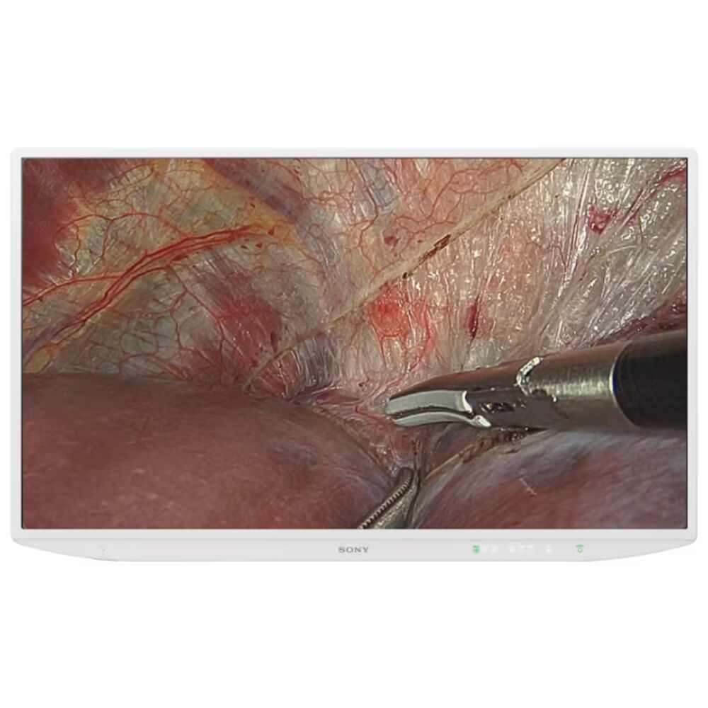 Sony LMD-XH550MD 55" 4K 2D Surgical Monitor - LMDXH550MD