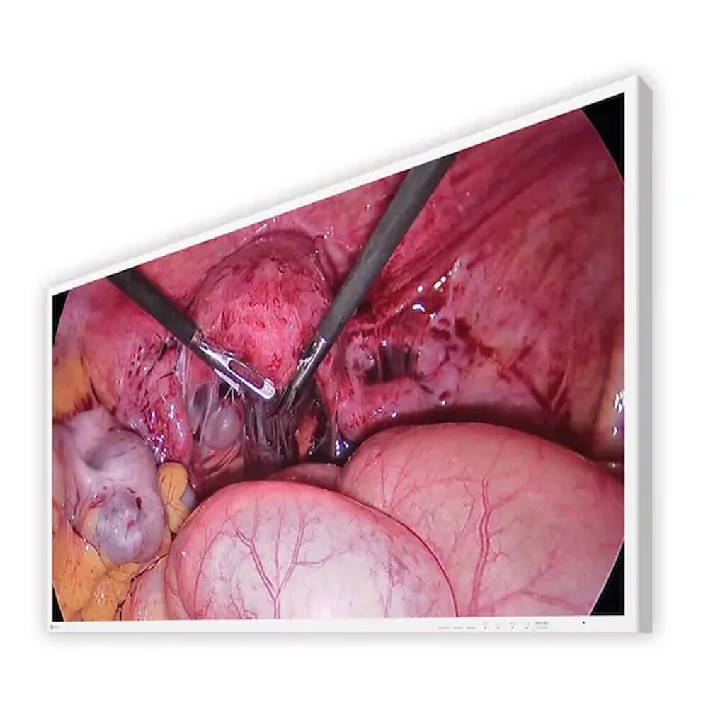 Eizo EX4342-3D 43" 4K 3D UHD Surgical Display Monitor - EX43423D