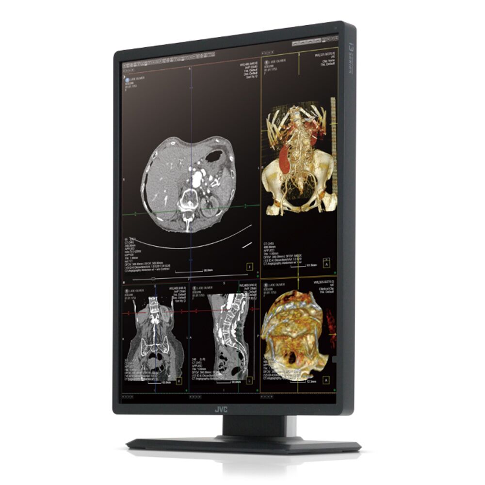 JVC CL-S301 (CLS301) 3MP Color Medical Monitor