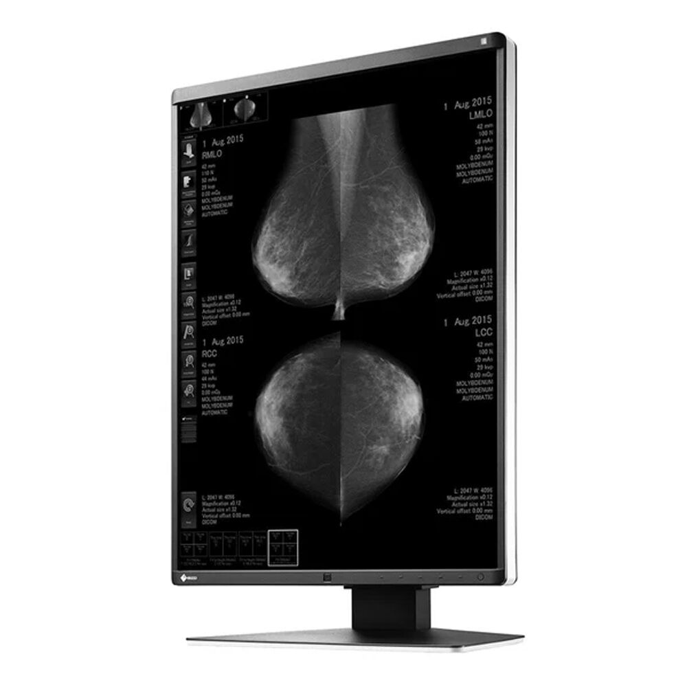 Eizo GX560 5MP Mammography Monitor