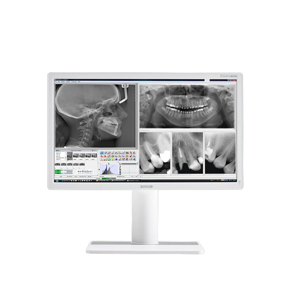 Barco MDNC-2123 Nio Color 2MP Dental Display (MDNC2123)