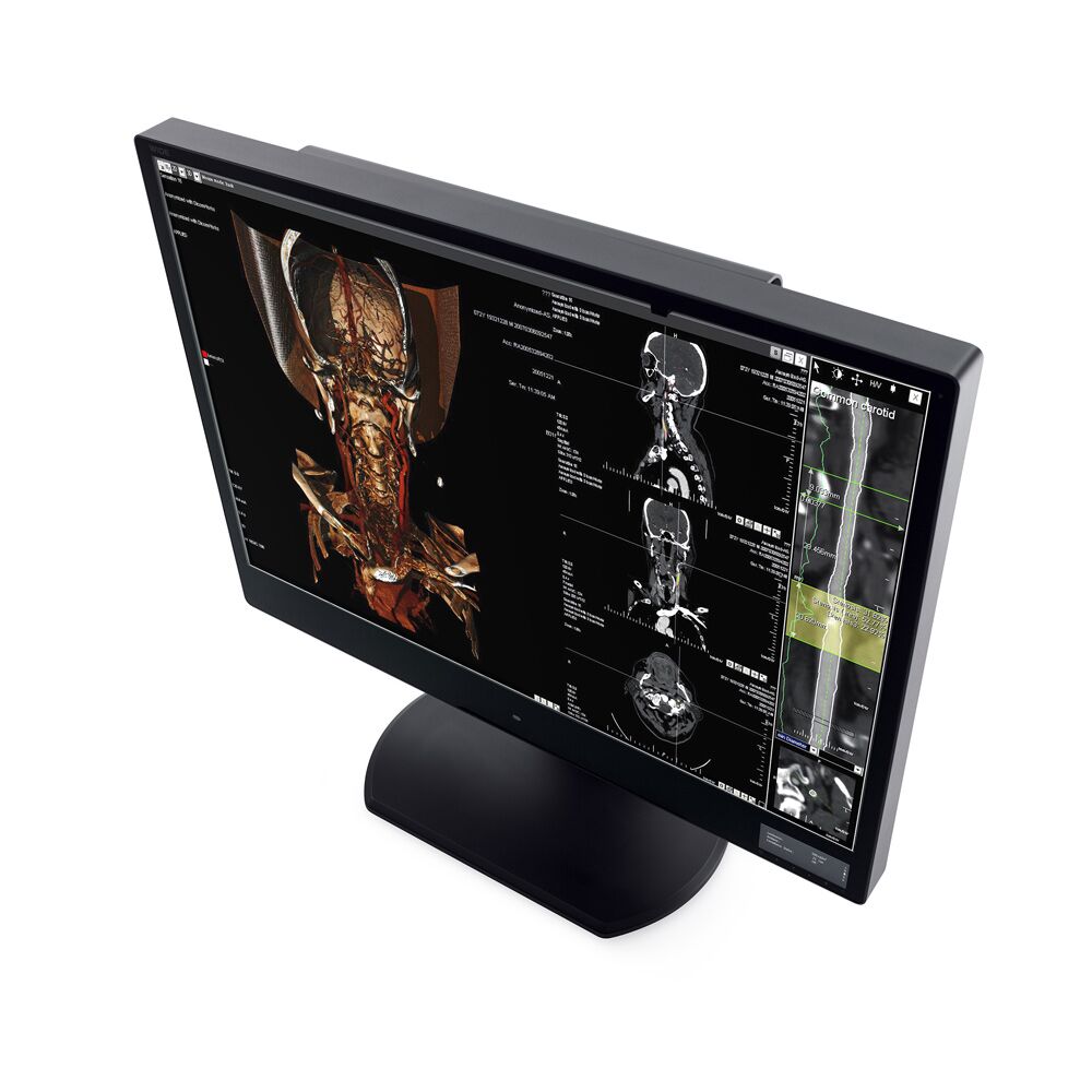 WIDE CW60N 6MP Diagnostic Color Display