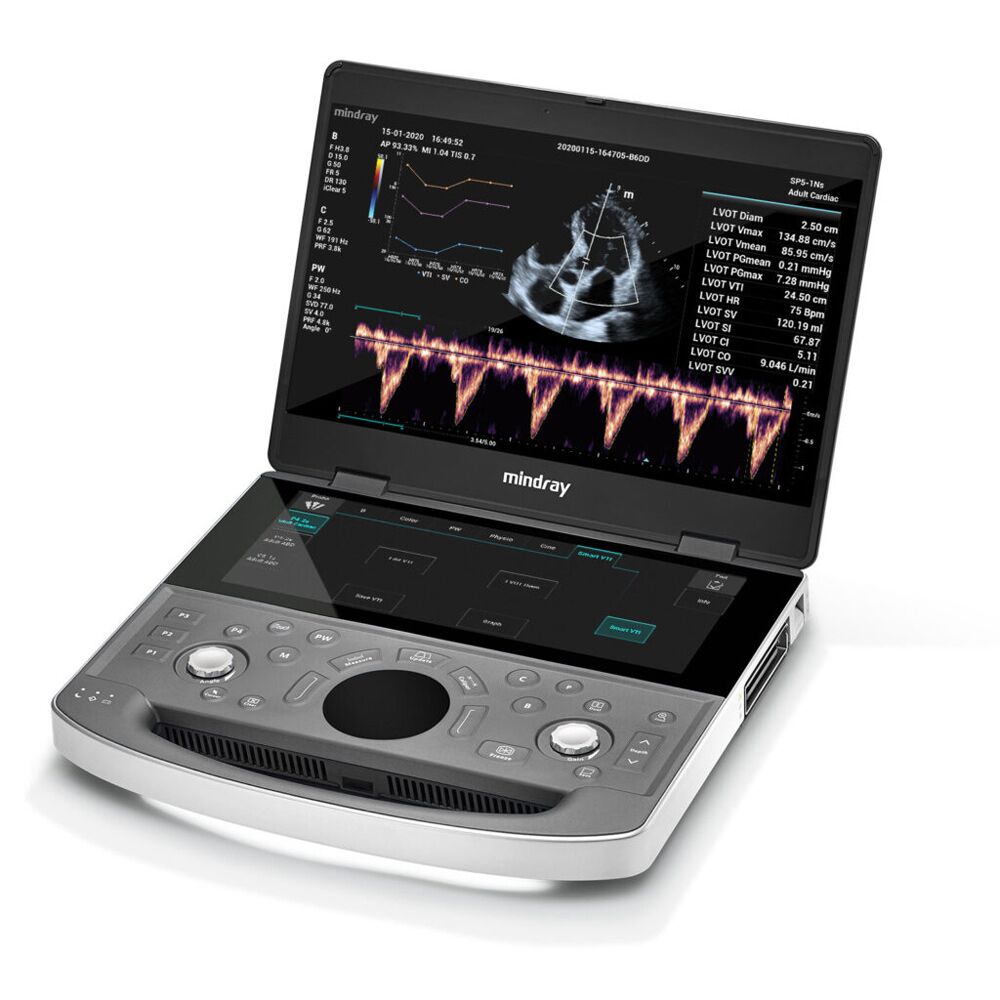 Mindray ME8 Portable Ultrasound System