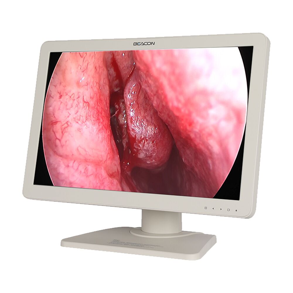 Beacon E2421 24" FHD Endoscopy Display