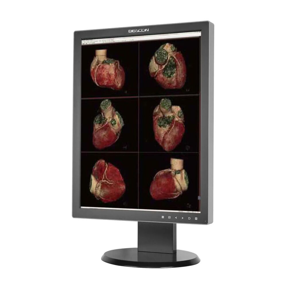 Beacon C22S+ 21.3" 2MP Color LED Diagnostic Radiology Display Monitor